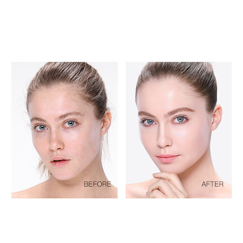 Gold Lifting Protein Threads™