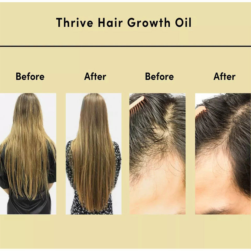 Hair Growth Oil™