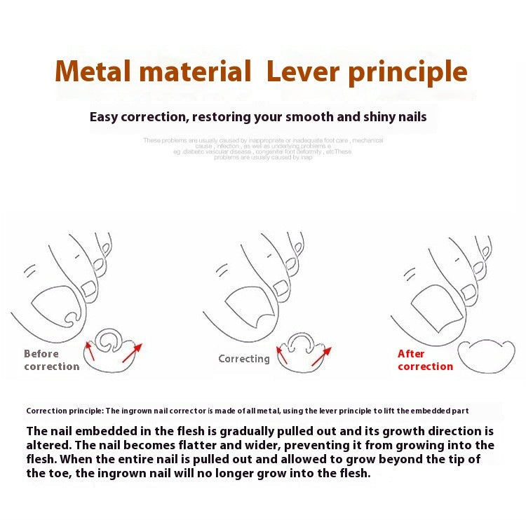 Nail Corrector Set™