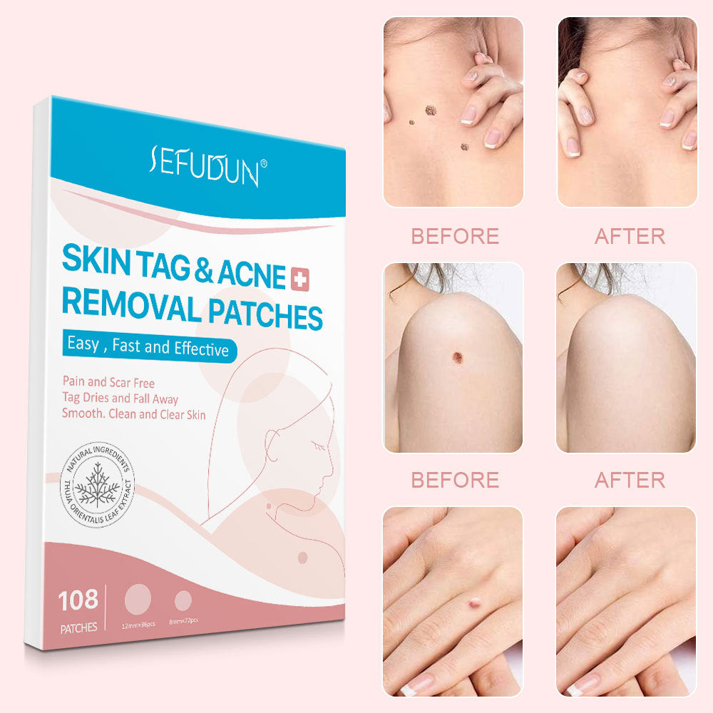 Skin Tag Removal Patches™